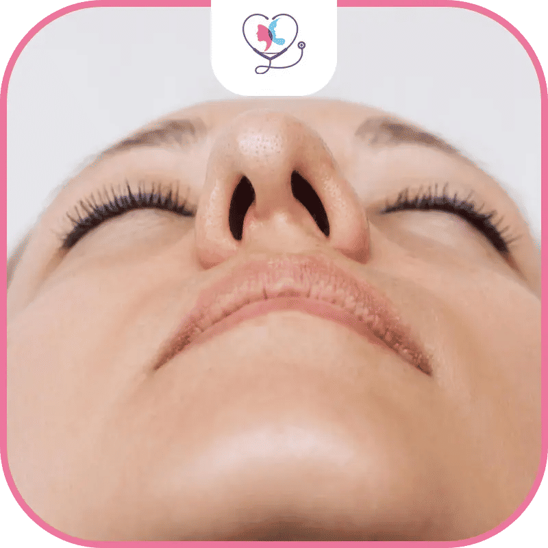 تجميل الأنف الوظيفي في تركيا