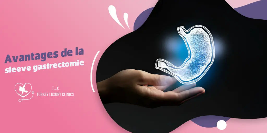 Avantages de la sleeve gastrectomie