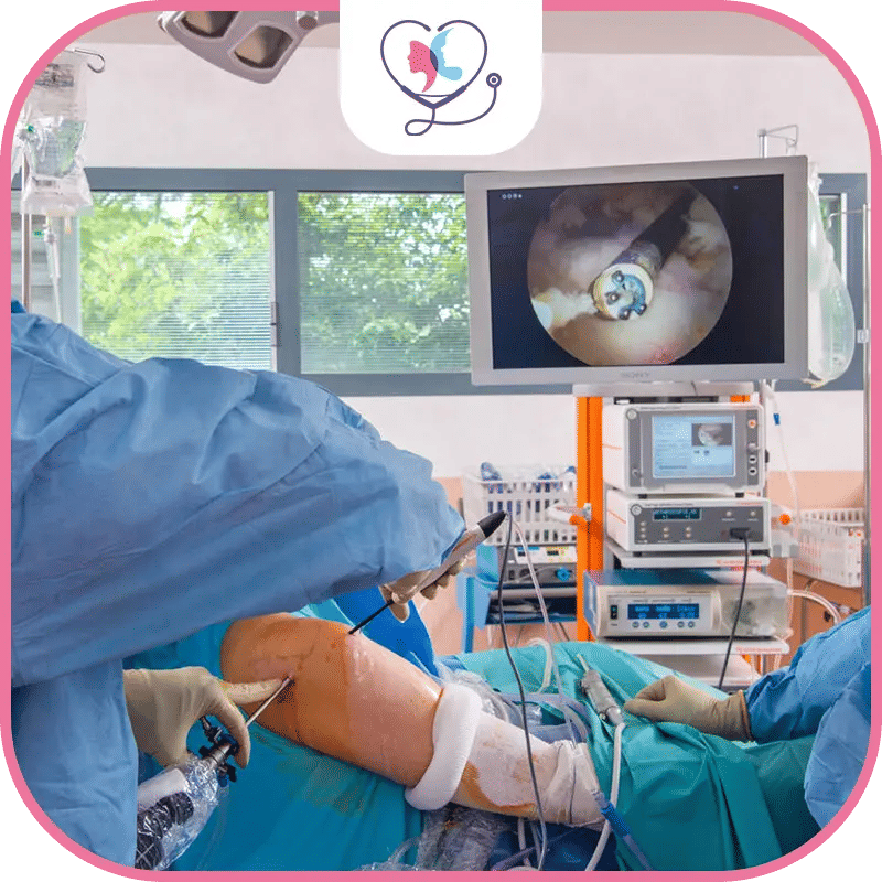 عملية تنظير مفصل الكتف