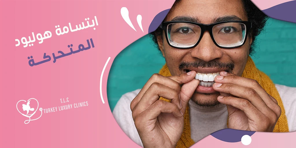 ابتسامة هوليود المتحركة سعرها في تركيا والسعودية وباقي الدول