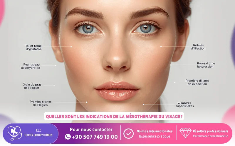Quelles sont les indications de la mésothérapie du visage?