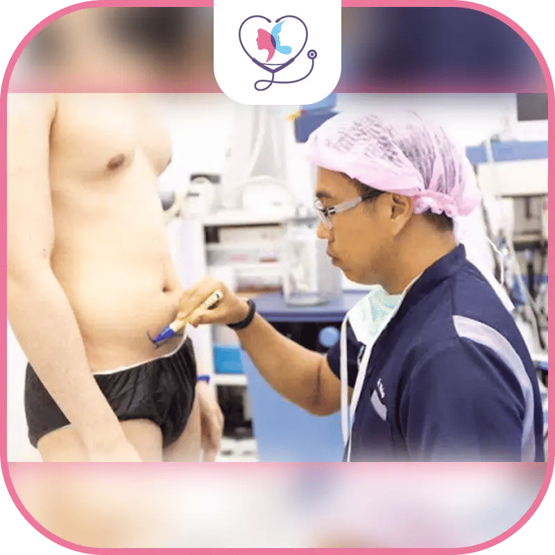 chirurgie six pack ratée