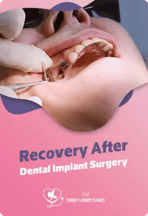 Recovery After Dental Implant Surgery: What to Expect and Tips for Smooth Healing