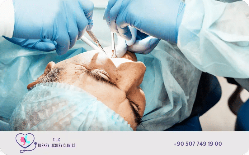 خطوات إيجاد أفضل مركز زراعة الأسنان في تركيا