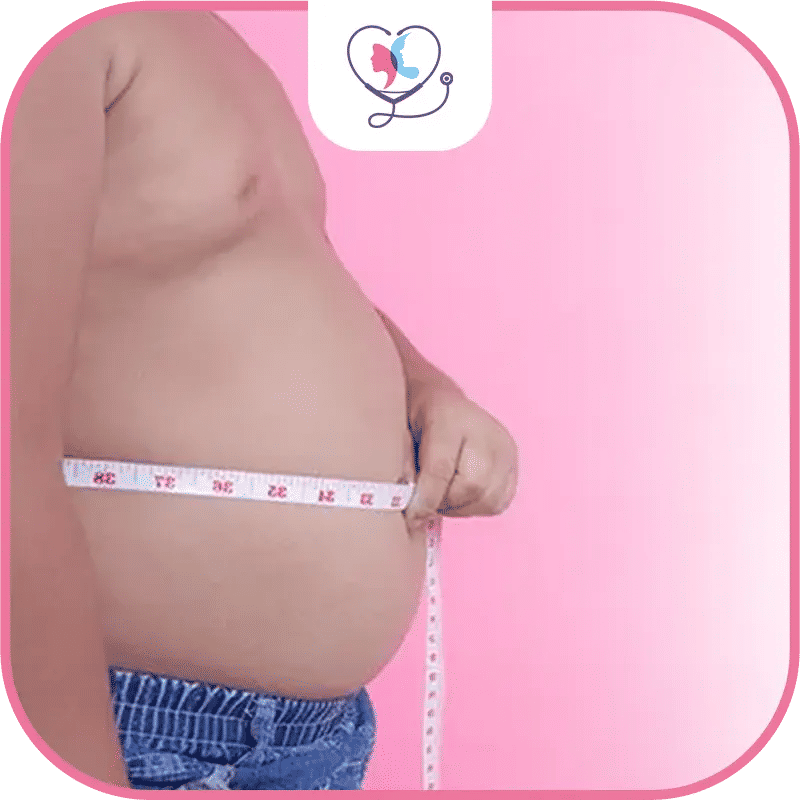 الحالة قبل تحويل المسار المصغر