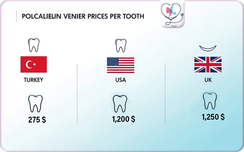 Comparison of Porcelain vs Other Veneer Types Cost