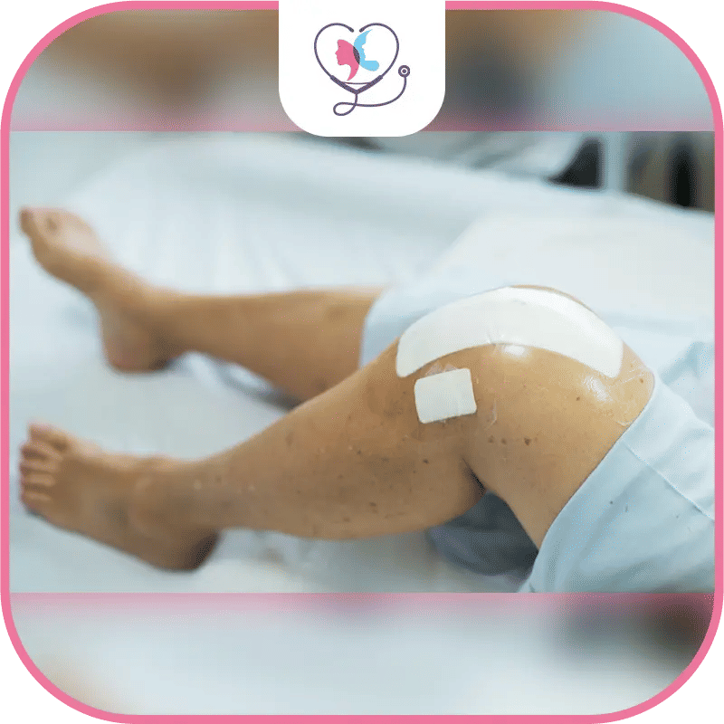 Quels sont les avantages de la prothèse partielle du genou ?