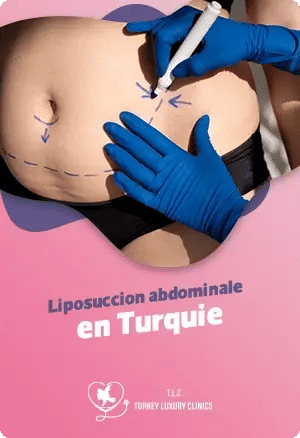 Liposuccion abdominale en Turquie