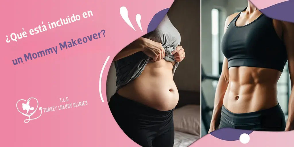 ¿Qué está incluido en un Mommy Makeover?