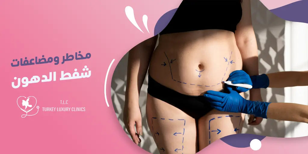 أضرار عملية شفط الدهون