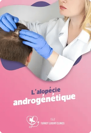 L'alopécie androgénétique