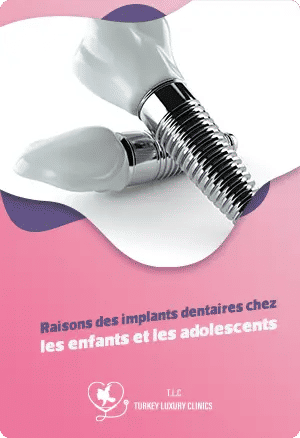 Raisons des implants dentaires chez les enfants et les adolescents