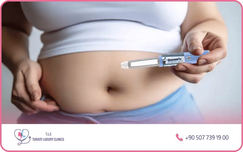 ما هي ابر التنحيف؟