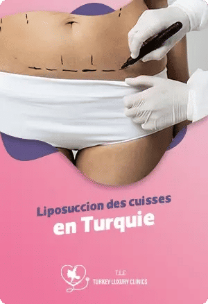 Liposuccion des cuisses en Turquie