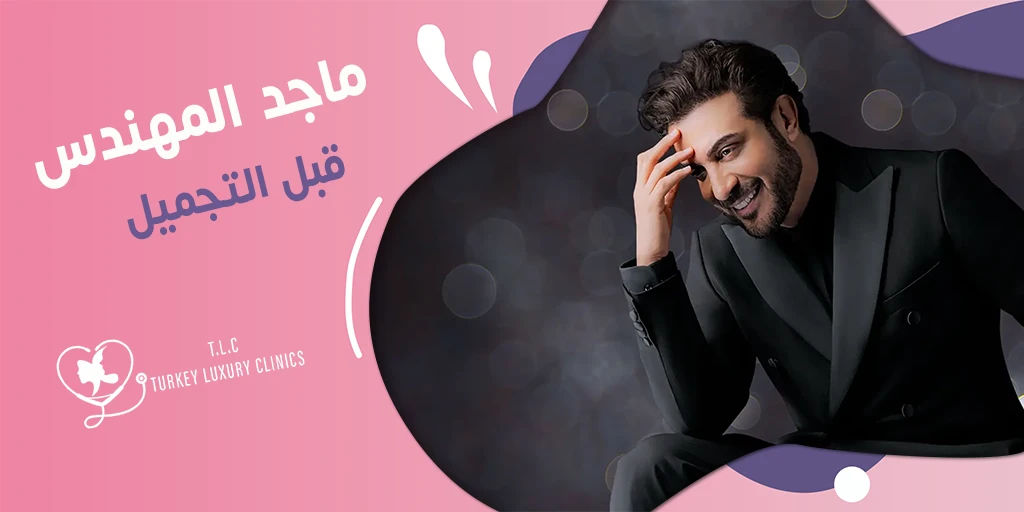 ماجد المهندس قبل التجميل: عمليات الأنف والوجه وزراعة الشعر