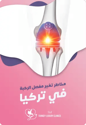 مخاطر عملية تغيير مفصل الركبة: كل ما يجب أن تعرفهfeatured image