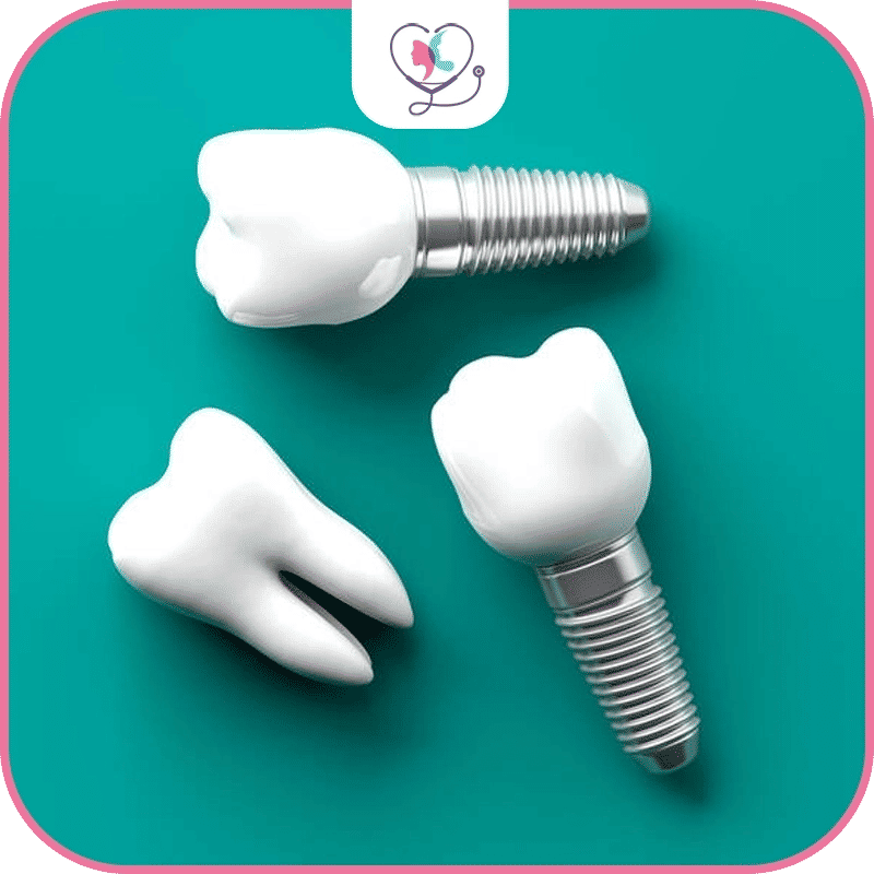 Demystifying the Cost of Dental Implants in Turkey 2025