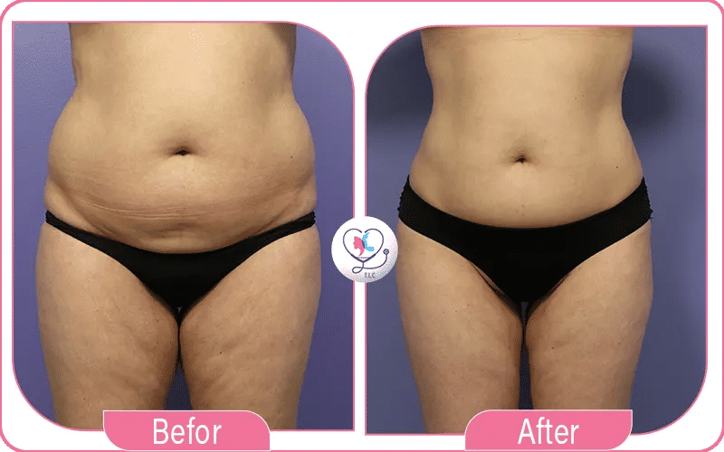 خامساً: تحسين الثقة بالنفس