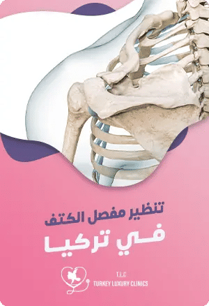 عملية تنظير مفصل الكتف في تركياfeatured image