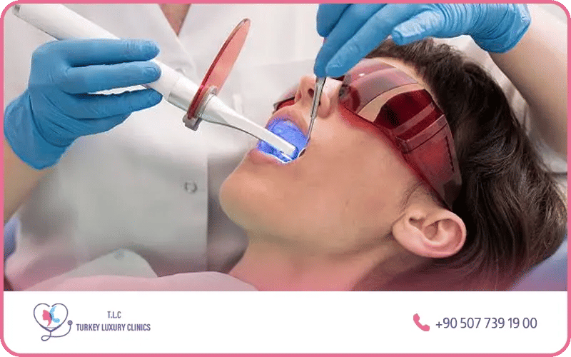 Best dental clinic Turkey for teeth whitening – Turkey Luxury Clinics Istanbul offering laser and Zoom whitening