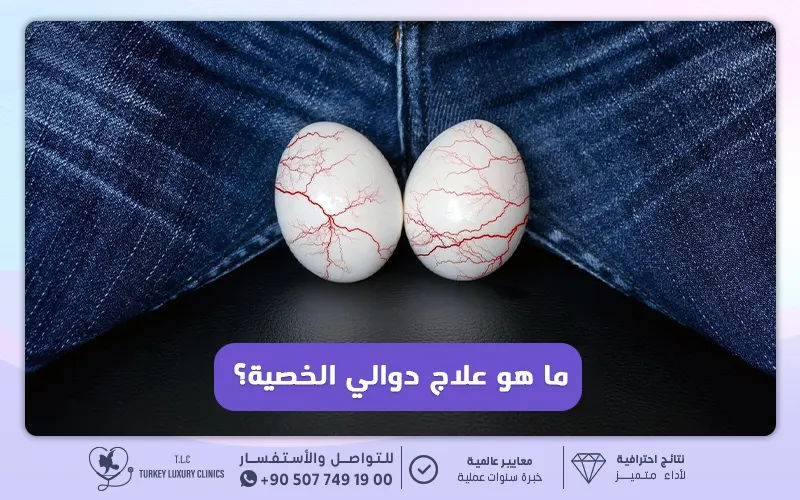 ما هو علاج دوالي الخصية؟