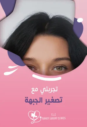 تجربتي مع عملية تصغير الجبهة: خفض خط الشعر 2.5 إلى 3 سم