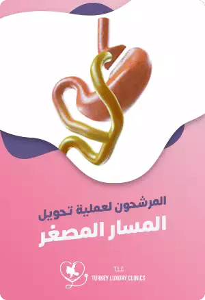 المرشحون لعملية تحويل المسار المصغرfeatured image