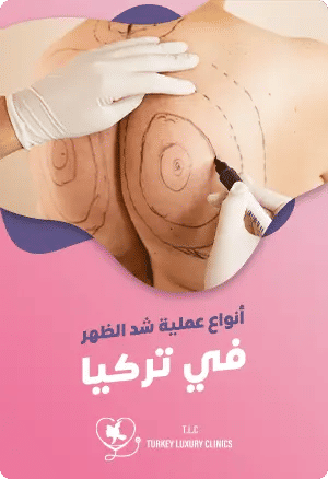 أنواع عملية شد الظهر في تركياfeatured image