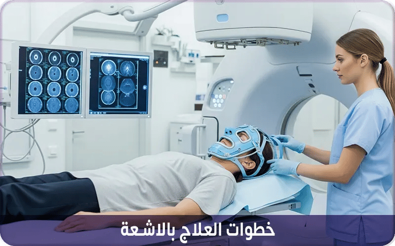 خطوات العلاج بالاشعة