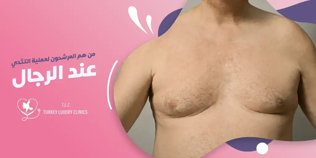 من هم المرشحون لعملية التثدي عند الرجال؟