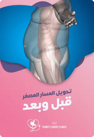 تحويل المسار المصغر قبل وبعدfeatured image