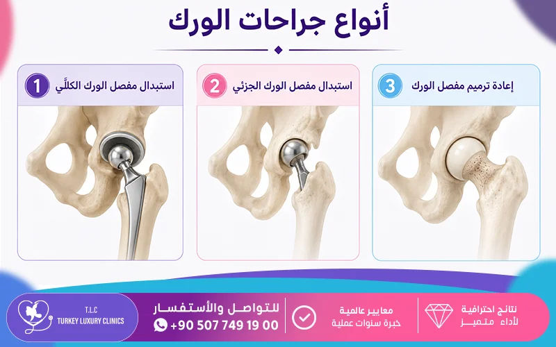 أنواع جراحات الورك