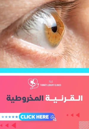 القرنية المخروطية: دليلك الشامل للأعراض والأسباب والعلاج