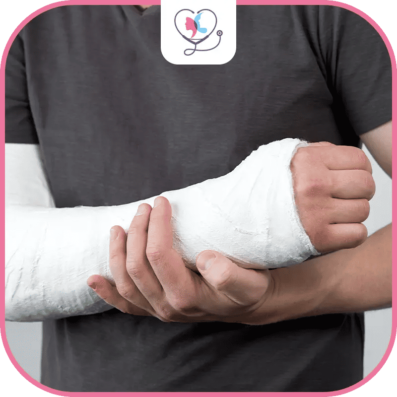 ما بعد جراحة اليد والأطراف العلوية في تركيا