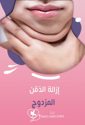 إزالة الذقن المزدوج: الطرق والنتائج والأسعارfeatured image