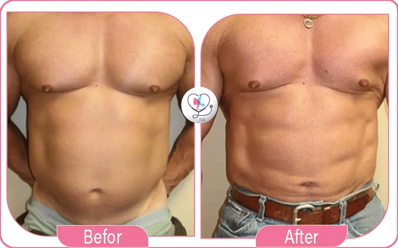 ثالثاً: النتائج غير المضمونة