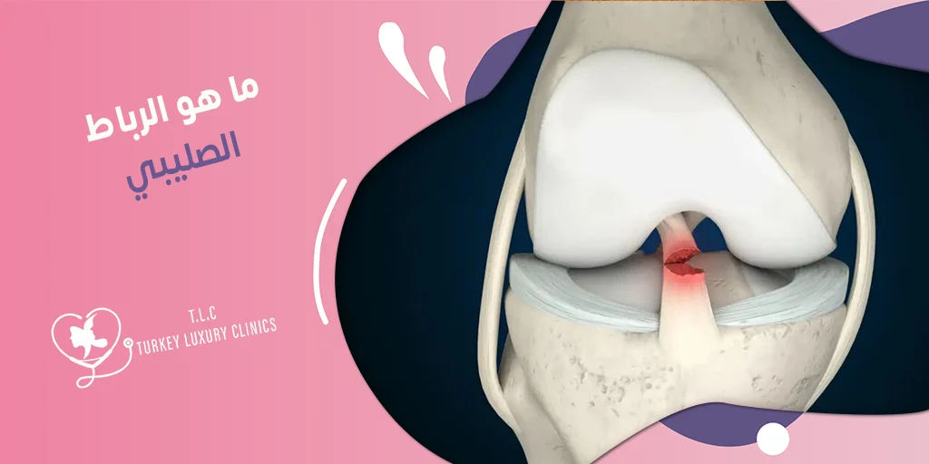 الرباط الصليبي: ما هو؟ وما هي الأعراض والأسباب؟