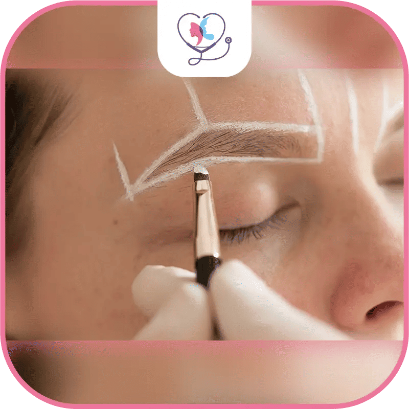 Greffe de sourcils ratée : comprendre les causes et trouver des solutions-1772045707053