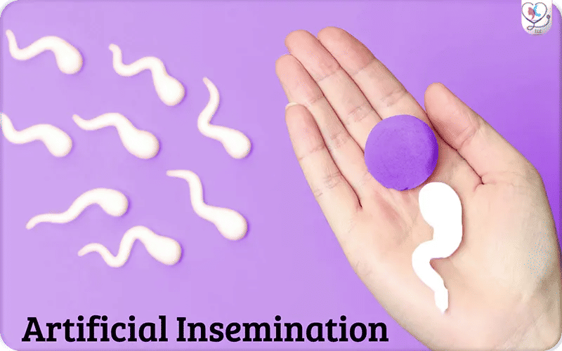Comment se passe une insémination artificielle ?