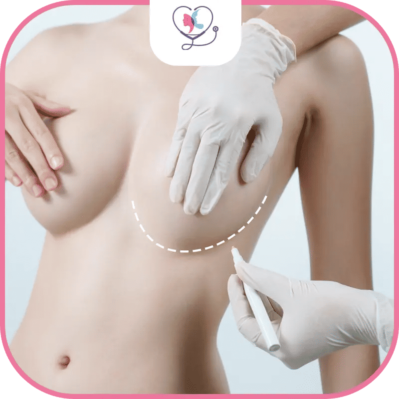 تقنيات عملية شد ورفع الثدي في تركيا