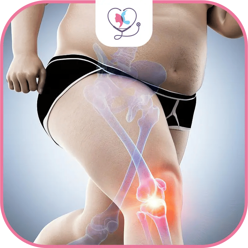 Why does obesity Rule Out Knee Replacement Surgery?