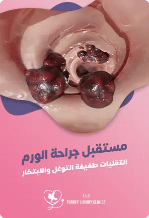 مستقبل جراحة الأورام: التقنيات طفيفة التوغل والابتكار