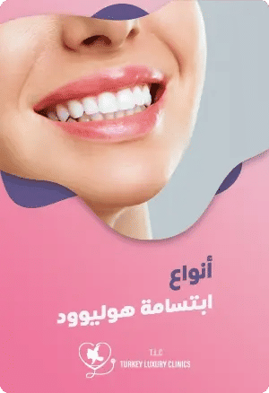 تعرف على أنواع ابتسامة هوليود المختلفة: دليل شاملfeatured image