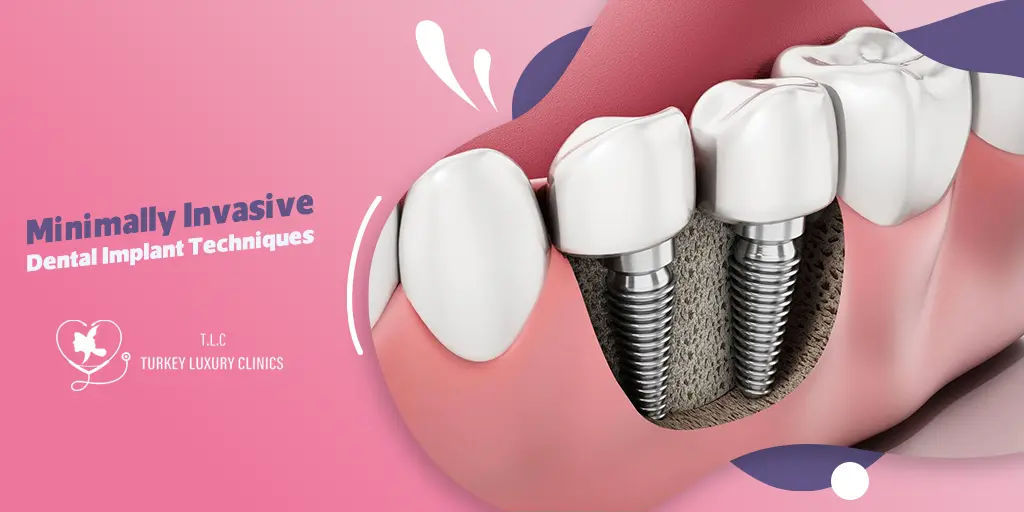 Minimalinvasive Zahnimplantate in der Türkei