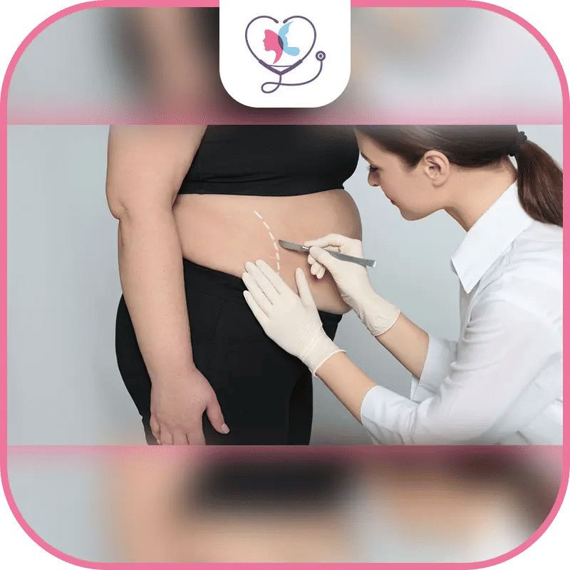 consulting a bariatric surgeon