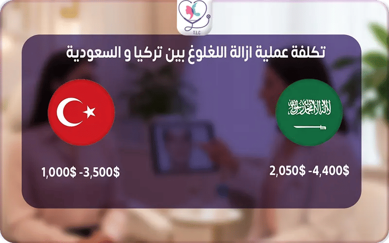 تكلفة عملية ازالة اللغلوغ في تركيا