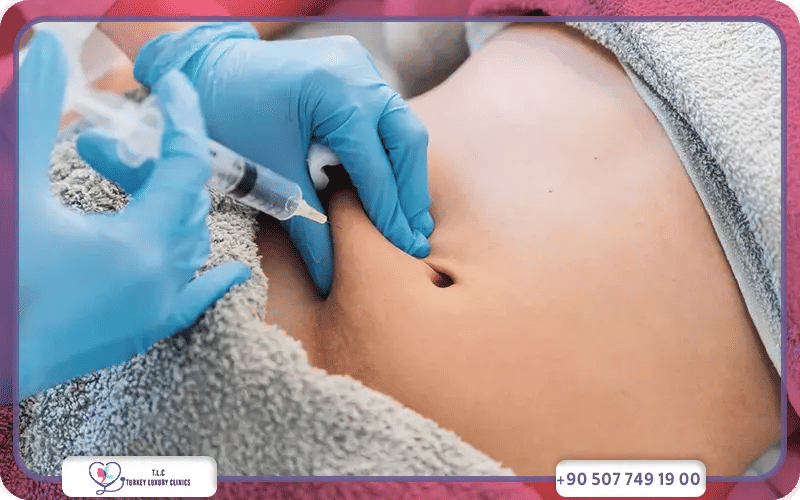 Who Are Fat Dissolving Injections Best For?