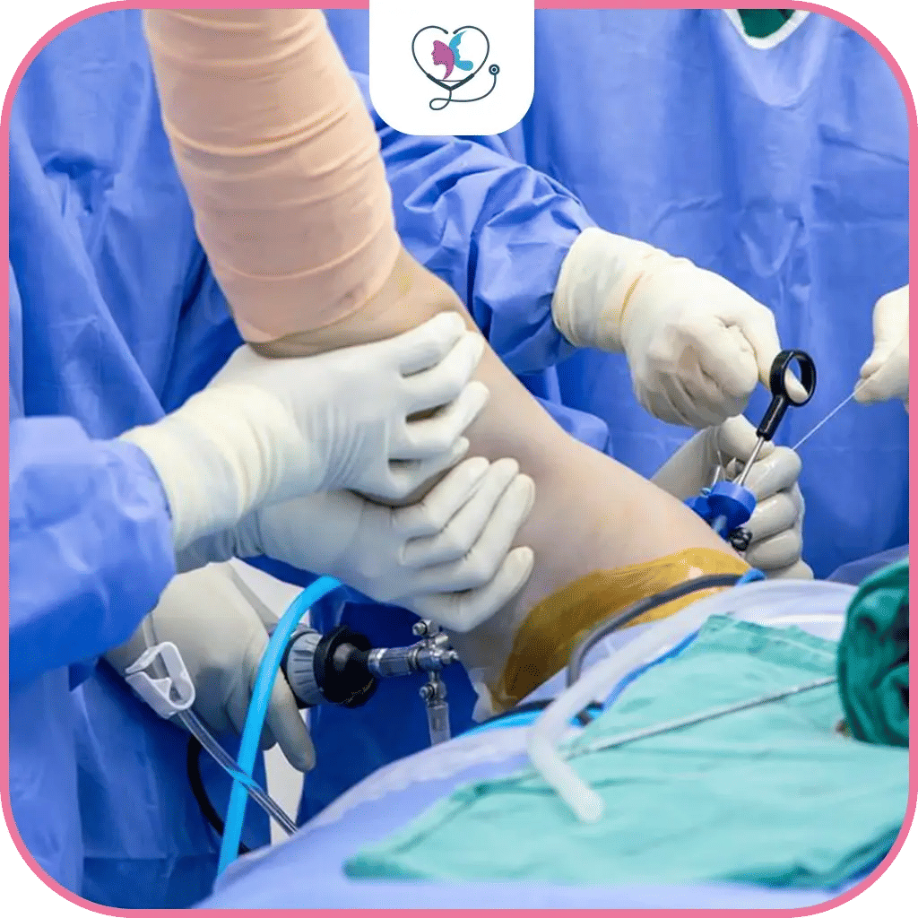 كيف يكون إجراء عملية تنظير الكتف في تركيا؟