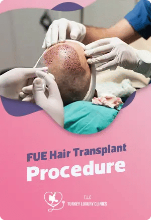 FUE Hair Transplant Procedure
