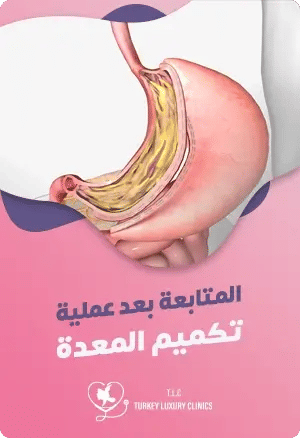 المتابعة بعد عملية تكميم المعدة: نصائح هامة للرعاية والنتائج المثاليةfeatured image